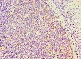 SEMA4C Antibody