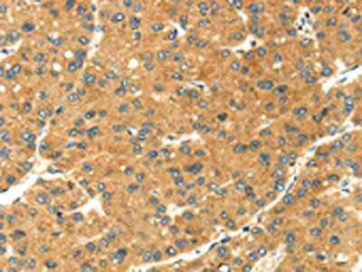 SEMA4C Antibody