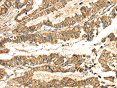 SEMA4C Antibody