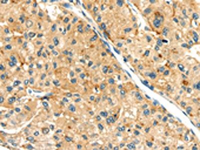 SEMA4C Antibody