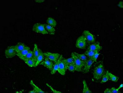 SEMA6A Antibody