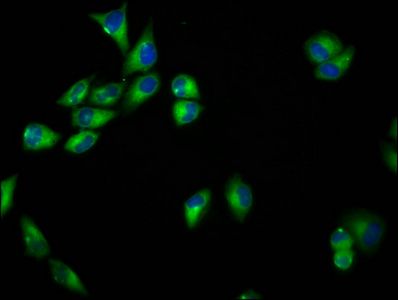SEMA6B Antibody