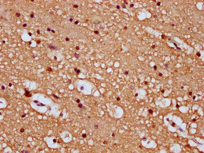 SEMA6B Antibody
