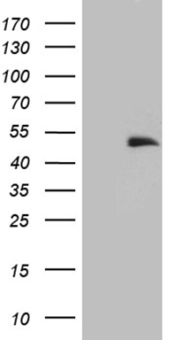 Semaphorin 4D Antibody