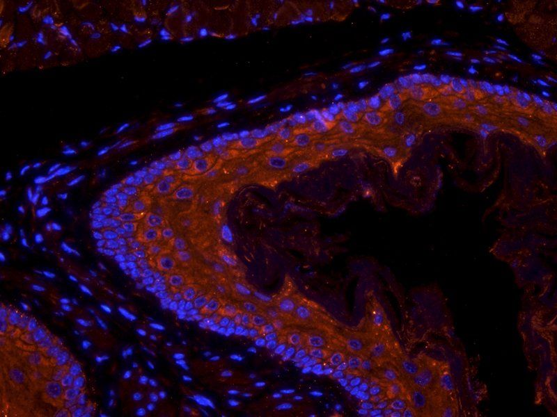 SEMA3A antibody