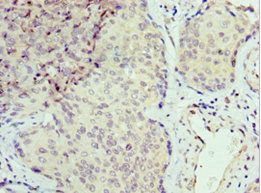 SEPT6 Antibody
