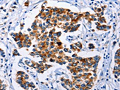 SERPINA3 Antibody