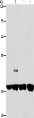 SERPINA9 Antibody