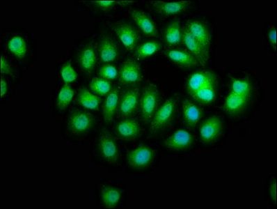 SERPINB12 Antibody