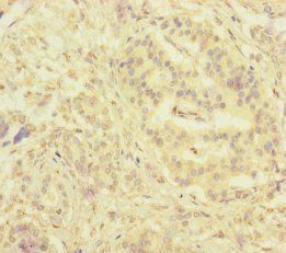 SERPINB6 Antibody