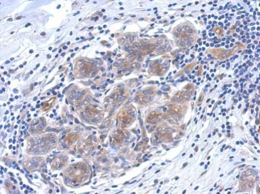 SERPINB6 Rabbit Polyclonal Antibody