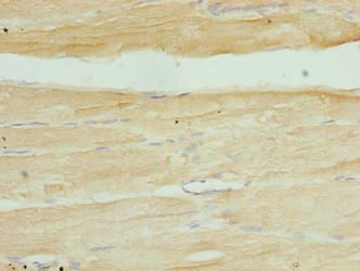 SERTAD1 Antibody