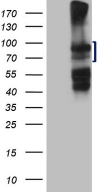 SETD2 Antibody