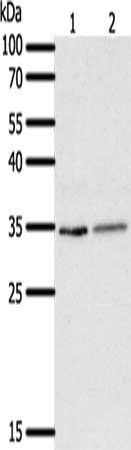 SFTPA1 Antibody