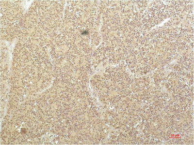 SGK1 Antibody