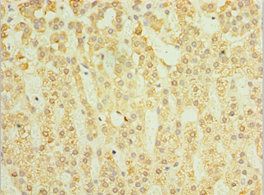 SGSH Antibody
