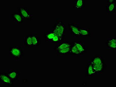 SH2D1B Antibody