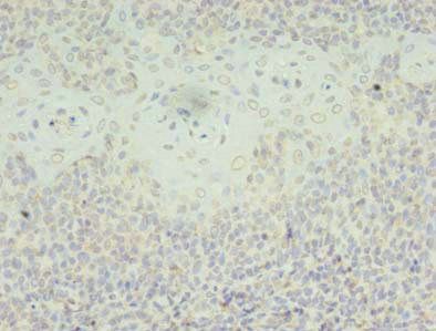SH3BGRL Antibody