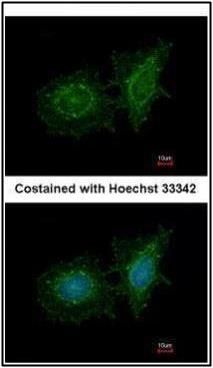 SH3BP1 Rabbit Polyclonal Antibody
