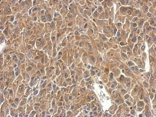 SH3BP1 Rabbit Polyclonal Antibody
