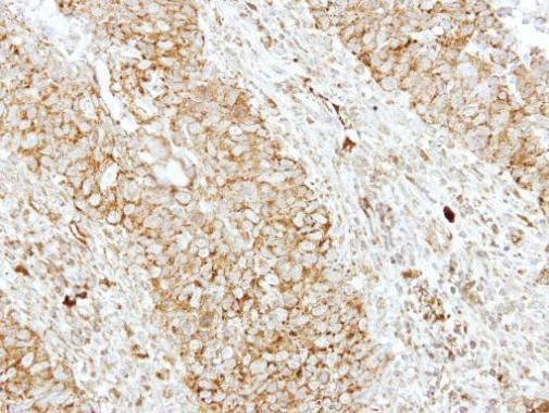 SH3GL1 Rabbit Polyclonal Antibody
