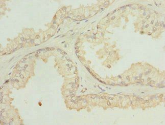 SH3GLB2 Antibody
