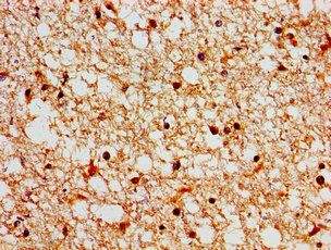SH3TC2 Antibody