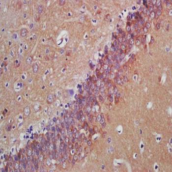 SPRN Rabbit Polyclonal Antibody