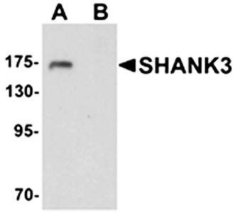SHANK3 Rabbit Polyclonal Antibody
