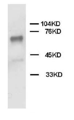 SHP2/PTPN11 Rabbit Polyclonal Antibody