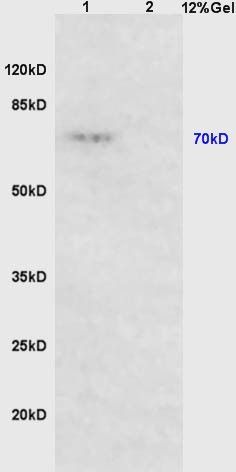 PTPN6 Rabbit Polyclonal Antibody