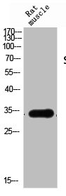 SIAH1/SIAH2 Antibody
