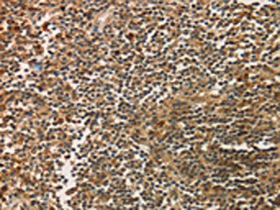 SIGLEC15 Antibody
