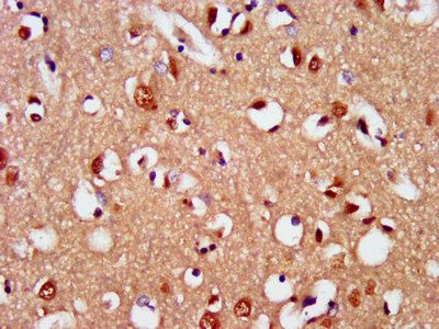 SIM2 Antibody