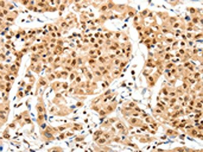 SIPA1 Antibody