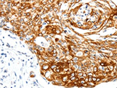 SIPA1 Antibody