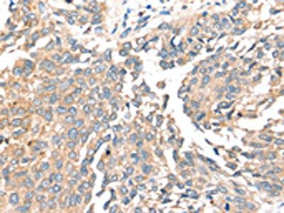 SIRT4 Antibody