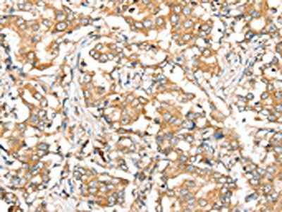 SIRT4 Antibody