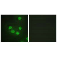 SIX6 Antibody