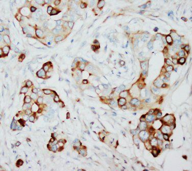 SKP2 Rabbit Polyclonal Antibody