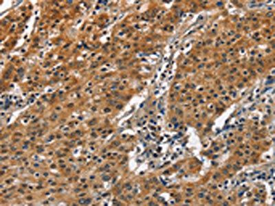 SLAMF8 Antibody