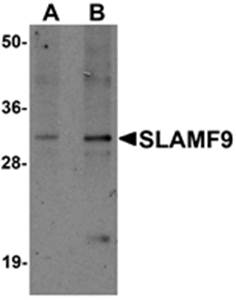 SLAMF9 Rabbit Polyclonal Antibody