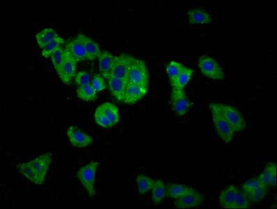 SLC12A5 Antibody