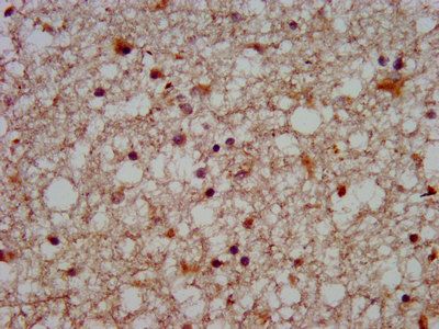 SLC12A5 Antibody