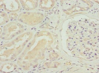 SLC12A6 Antibody