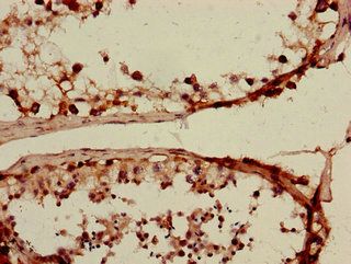SLC15A3 Antibody
