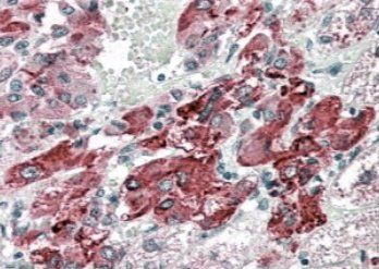 VMAT2/SLC18A2 Antibody