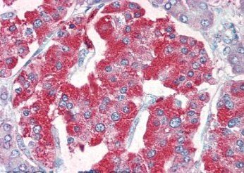 VMAT2/SLC18A2 Antibody