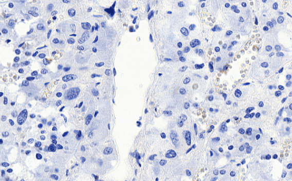 VMAT2/SLC18A2 Antibody