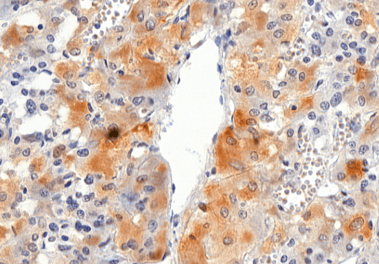 VMAT2/SLC18A2 Antibody